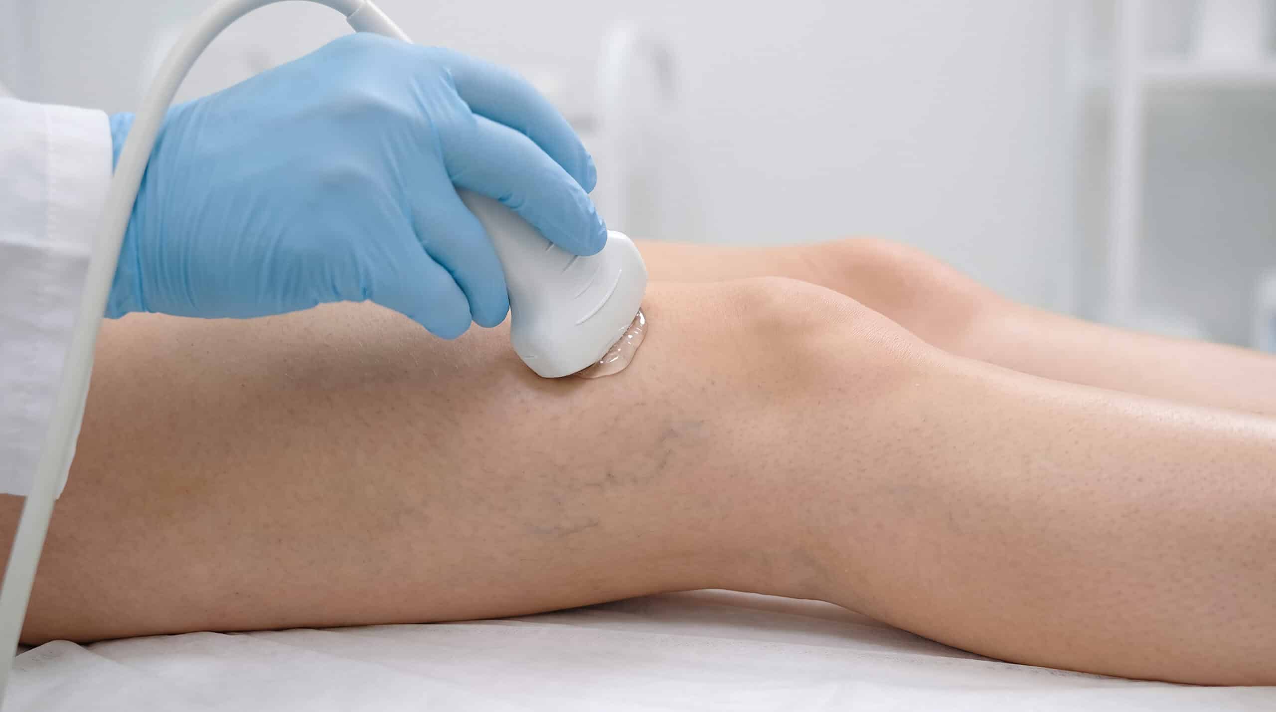 Vascular Testing